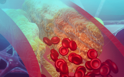 Cleerly – Finds the High-Risk Patients that Calcium Scoring Misses