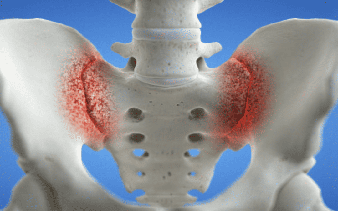 STEM CELLS & PLATELET RICH PLASMA (PRP) FOR SACROILIITIS