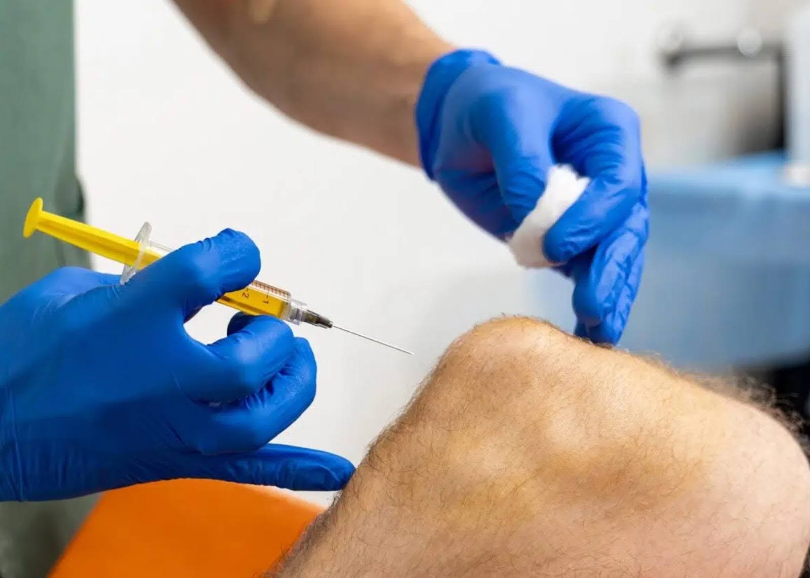 Stem Cell Therapy for Knee Pain: Complete Recovery Guide