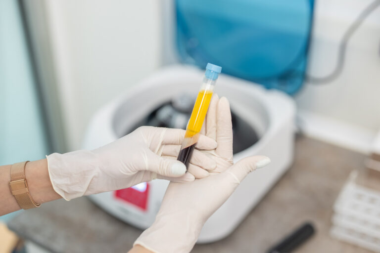 best platelet-rich plasma therapy clinic